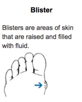 Blister